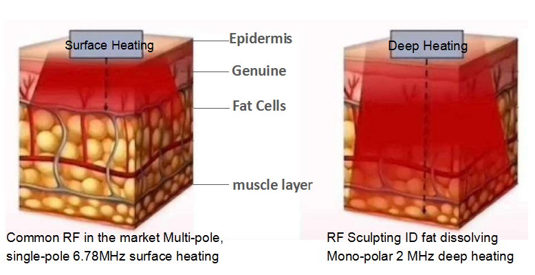 La última máquina llena RF caliente del retiro de las grasas de cuerpo 2022 que esculpe TruSculpt 3D Tru esculpe terapia monopolar de la identificación RF