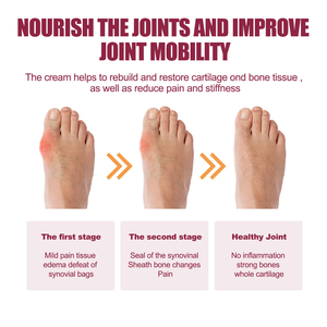 Crema Herbal para Articulaciones, para Artritis Reumatoide, Dolor Cervical, <span class=keywords><strong>de</strong></span> Rodilla y Muscular, Masaje Relajante - Product Image 4