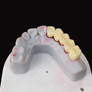 OEM/ODM servizi di laboratorio odontoiatrico perfetto aspetto belle corone in ceramica di <span class=keywords><strong>Zirconia</strong></span> con gomma realistica in Cina laboratorio odontoiatrico - Product Image 2