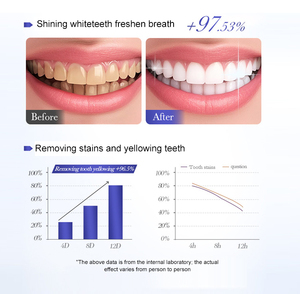Pasta Dental Blanqueadora ONE para Dientes Sensibles, Protección del Esmalte, Pasta Dental con Flúor y Menta Fresca para Adultos, Cuidado Bucal Diario - Product Image 4