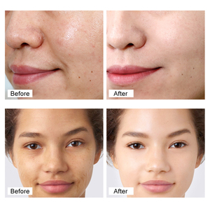 Crema de Alta Calidad para Eliminar Pecas, Antiarrugas, Blanqueadora, con Colágeno, Retinol, Glicerina, Niacinamida y Ginseng - Product Image 3