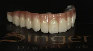 مكعبات وأقراص من الزركونيوم 95 مم Yucera 4D Pro لاستعادة الأسنان مريحة وعالية الجودة