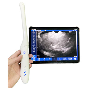 Escáner <span class=keywords><strong>de</strong></span> Ultrasonido Doppler Transvaginal Inalámbrico CProbe-4T, 96 Elementos, 32 Canales, para Examen <span class=keywords><strong>Vaginal</strong></span> - Product Image 5