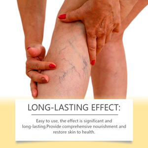 La Nueva Crema para el Alivio de las Várices en las Piernas a Bajo Precio es Fácil de Usar y Suave Sin Irritación. - Product Image 3