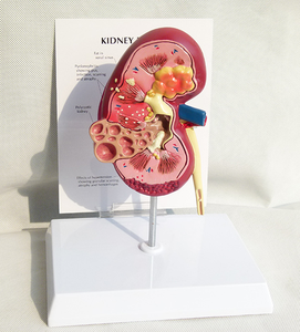 نماذج أبحاث التشريح الطبي ، عالية الجودة, نماذج أمراض الكلى ونماذج الكلى الصحية - Product Image 4
