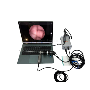 Neuroendoscopio Rigido SY-P2113 con Kit Guaina 0 ° /30 °   Ventriculoscopio per Esame delle Ventricoli Cerebrali - Product Image 3
