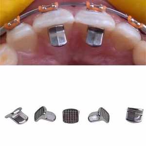 Placa lingual dental, placa oclusal de ortodoncia, dispositivo desechable para el cuidado bucal para adultos, 100 unidades por caja MK06-807 - Product Image 5