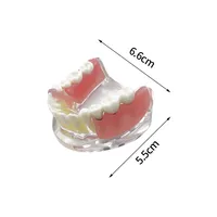 Modelo de Dientes de Mandíbula Inferior Removible con Implante, Restauración de Puente, Modelo de Implante Dental para Educación, Enseñanza, Estudio y Práctica