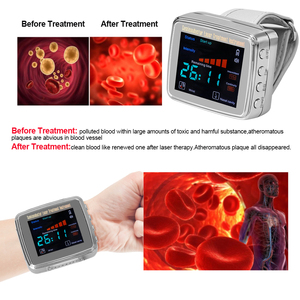 Reloj de Terapia Láser de 13 Orificios y 650nm con Diodo LLLT para la Presión Arterial Alta y la Sinusitis, Irradiación Láser - Product Image 3