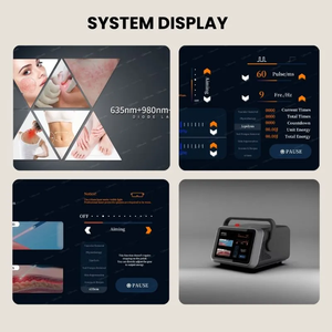 Láser de Diodo de Múltiples Longitudes de Onda 980nm 1470nm 635nm para Terapia Antiinflamatoria y Lifting Facial Endoscópico - Product Image 6