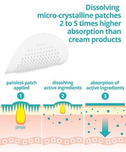 Patch anti-imperfections à micro-aiguilles ultra-fin et invisible, patch pour le soin de la peau du visage, protection douce de la peau - Product Image 4