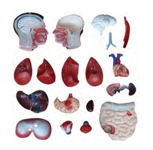 85cm Nam thân trên 19 phần - Product Image 3