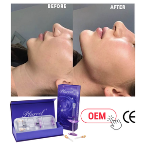 Approvisionnement en gros de 1 ml de produit de comblement cutané HA réticulé pour les spas médicaux et les cliniques esthétiques dans le monde entier - Product Image 1