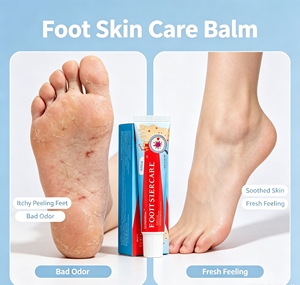 Baume pour les pieds ETHEREAL à base d'extraits naturels doux d'herbes, traitement antifongique, apaise les peaux sèches et irritées, élimine les odeurs de pieds, 20g - Product Image 5