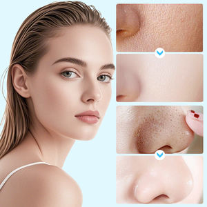 Gel Nettoyant Points Noirs à la Camomille MOOYAM Marque Privée – Gel Anti-Points Noirs <span class=keywords><strong>Bye</strong></span> <span class=keywords><strong>Bye</strong></span> Blackhead Remover 170g - Product Image 3