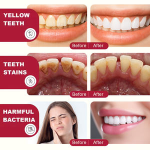 הגנה מסטיק וקרם בריאות השן מפחית רגישות הפה, מנקה ומזירי שיניים. משחת שיניים בריאות יומית - Product Image 3