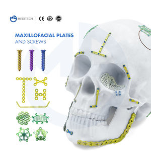 CZMeditech Orthopedische Implantaten Titanium Maxillofaciale Plaat CMF Plaat 2.0mm Dubbele Y-Plaat CMF Intern Fixatiesysteem - Product Image 3