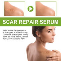 Suero Líquido con Vitamina C para Reparación de Cicatrices, 30 ml, Marca Privada OEM, Silicona, Reduce Cicatrices Planas, Queloides, Quemaduras, Cirugía, Vegano, para Mujeres, Todo Tipo de Piel