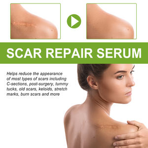 Suero Reparador de Cicatrices 30ml, Marca Privada OEM, Silicona Médica, Aplana Cicatrices, Queloides, Quemaduras, Cirugía, Vegano - Product Image 4