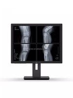 Nouveau 21.3 pouces 3Mega M écran vertical échelle de gris CT lecture X-ray DR radiologie diagnostic DICOM moniteur médical