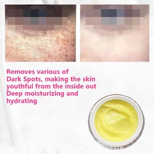 Crema Cosmética Blanqueadora e Iluminadora para Eliminar Manchas de la Edad - Corrector de Manchas Oscuras, Aclara la Piel - Hidratante y Abrillantadora - Product Image 2