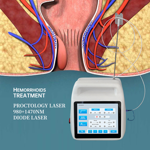 Máquina Láser Eficaz para Hemorroides, Equipo Médico de Corte Láser para Proctología de 980nm y 1470nm Utilizado por Proctólogos - Product Image 4