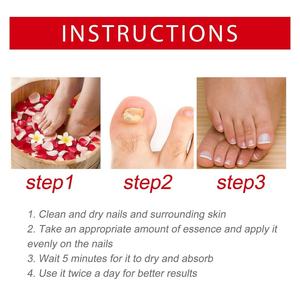 Solución Reparadora de <span class=keywords><strong>Uñas</strong></span> South Moon Herbal 20ml, Limpia, Blanquea y Nutre <span class=keywords><strong>las</strong></span> <span class=keywords><strong>Uñas</strong></span>, Cuidado Antifúngico <span class=keywords><strong>para</strong></span> <span class=keywords><strong>Uñas</strong></span> de los Pies, Paquete Individual - Product Image 6