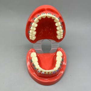 โมเดลฟันเรซินพร้อมลวดจัดฟันและลวดสลิงสำหรับอุปกรณ์ทันตกรรมแหล่งพลังงานด้วยตนเอง - Product Image 4