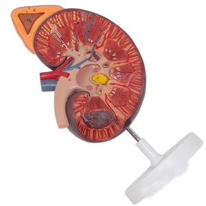 Modelo de riñón con glándula adrenal, Urology y nefrology, modelo de comunicación médico-pacientes - Product Image 1