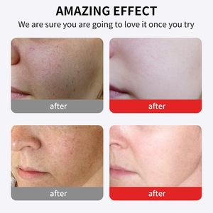 Crema Facial Hidratante, Nutritiva, Iluminadora y Exfoliante con Ácido Kójico para Todo Tipo de Piel, 50g - Product Image 4