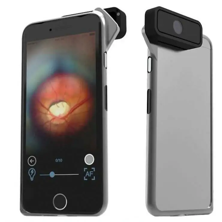 Fundus Photography D-Eye Portable Ophthalmoscope