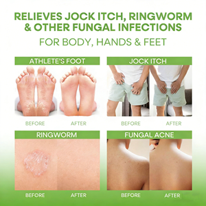 Jabón Sólido Antifúngico con Aceite de Menta, Alivio 6 Veces Más Rápido para Pie de Atleta, Picazón en la Rodilla, <span class=keywords><strong>Tiña</strong></span>, Limpieza Corporal Herbal Natural OEM - Product Image 4