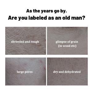 سيروم للتحكم في الزيوت للمراهق وتقليص المسام الدهنية وتجديد شباب البشرة سيروم لعلاج حب الشباب سريع الفعالية لبشرة الوجه - Product Image 4