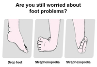 Attelle orthopédique réglable pour pied tombant, soutien de la cheville à dorsiflexion, design respirant et écologique, protection unisexe