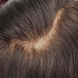 Sistema de Reemplazo Capilar para Hombres con Cabello Humano 100% Remy, Toupee de Encaje Suizo, Línea Capilar Natural, Peluca Completa de Encaje Suizo para Hombres - Product Image 2