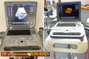 Ultrasound Veterinary Cheap Price Handheld Ecograph Portable Black And White Pregnancy Veterinary Ultrasound With Convex Rectal Probe