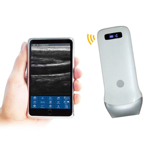 Échographe sans fil UProbe-<span class=keywords><strong>3L</strong></span>, scanner à ultrasons linéaire portatif noir et blanc, appareil médical portable à ultrasons - Product Image 2