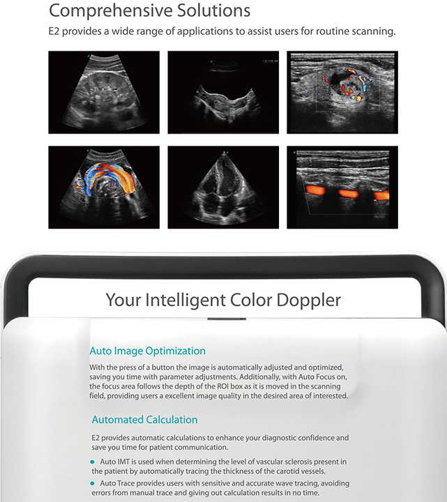 Medsinglong Medical Ultrasound Instrument MSK OB/GYN 3D 4D 5D Ultrasound Scanner Sonoscape E2 Portable Ultrasound Machine