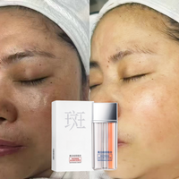 Produits OEM à forte demande Crème blanchissante pour le visage Dissolvant de taches de rousseur Éclaircissant pour la peau Niacinamide Effaceur de taches noires pour le visage