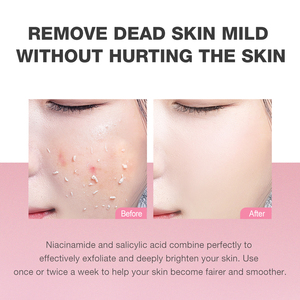 SKINEVER Niacinamide esfoliante Gel detergente viso con Centella per la pulizia profonda della pelle e rimuovere il tono scuro della pelle - Product Image 5