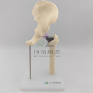 מודל החלפת מפרק ירך, מודל רופא מנתח רפואי של רופא-חולה, מיני גירסה - Product Image 3