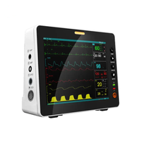 Chaud pas cher vétérinaire portable moniteur vétérinaire etco2 vétérinaire capnographie etco2 moniteurs de signos vitales