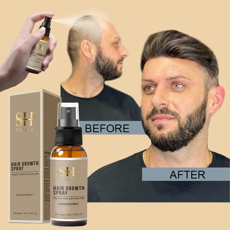 Aceite para el crecimiento del cabello de cabeza calva para hombre orgánico, aerosol para el crecimiento del jengibre y antipérdida de cabello, recién llegados