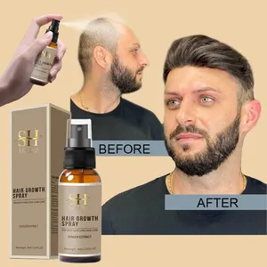 New Arrivals Mans Orgânicos Cabeça Careca Óleo De Crescimento De Cabelo Anti Perda De Gengibre De Crescimento Spray De Cabelo