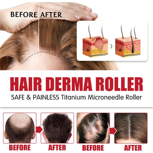 G Suero para el crecimiento del cabello Reduce la caída del cabello Tratamientos para la pérdida de cabello Densidad del cabello para un cabello más grueso y completo para mujeres y hombres - Product Image 4