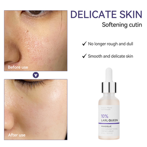 OEM/ODM Logo personnel personnalisé Soins du visage Essence Acide d'amande Brossage Adoucissant Cutine Réparation Sérum <span class=keywords><strong>anti</strong></span>-acné Essence - Product Image 3