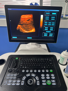 Échographe <span class=keywords><strong>Doppler</strong></span> Couleur Portable Mindray DC-80A 4D 5D – Instruments d'Échographie Médicale pour Hôpitaux - Product Image 3