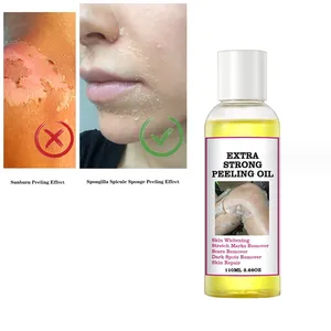 Real Yellow Peeling Oil Knuckles Skin Whitening Remove Dead Skin Exfoliating Extra Strong Peeling Oil