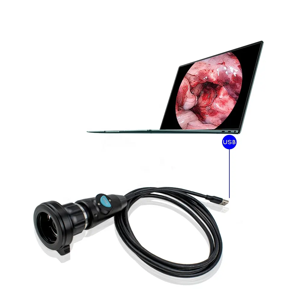 USB 3,0 Interfaz 1080P HD Cámara médica con mango de endoscopio con alta resolución Cmos