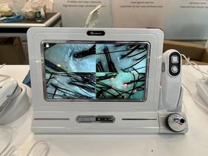 Analizador Inteligente de Cuero Cabelludo con IA 2025, Bloqueos de Folículos Pilosos Visibles con 1 Clic - Product Image 2